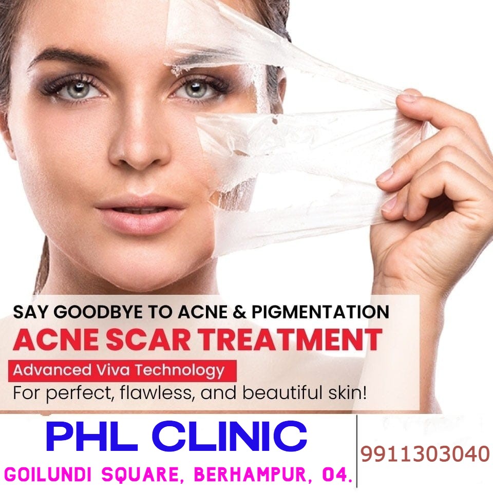 Acne scar treatment — advanced Viva technology
